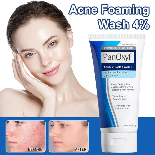 PanOxyl® Acne Creamy Wash Benzoyl Peroxide  4% 156g