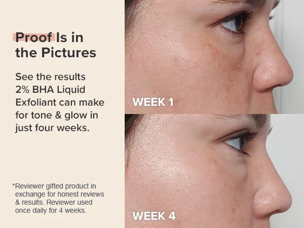 Paula's Choice SKIN PERFECTING 2% BHA Liquid Exfoliant